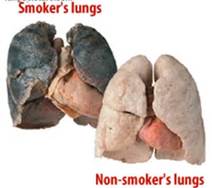 Compare Smokers Lungs with a Non-Smokers Lung